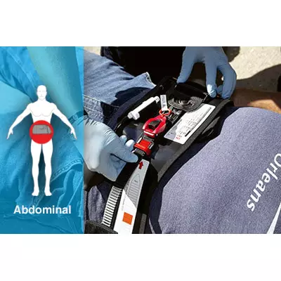 Abdominal Aortic & Junctional Tourniquet-Stabilized (AAJT-S)