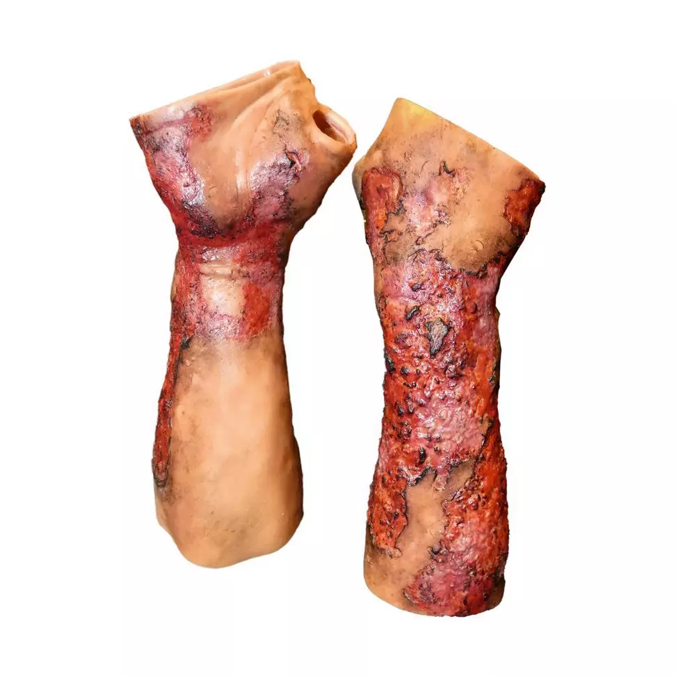Techline Moulage Schwere Verbrennung - Unterarm (rechts)