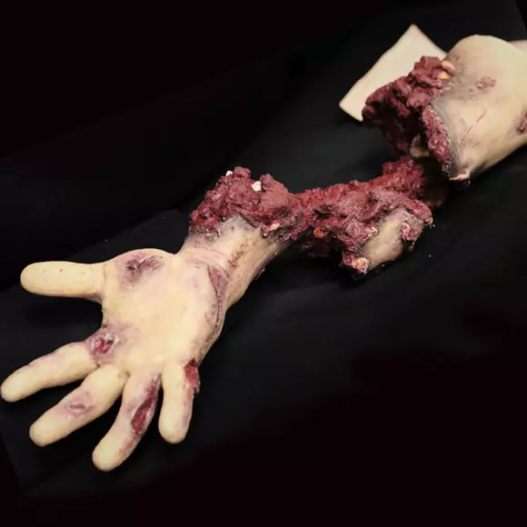 Techline Moulage partial amputation arm with hard bone (right)
