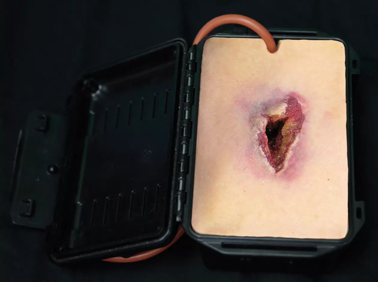 Techline shrapnel wound in a box